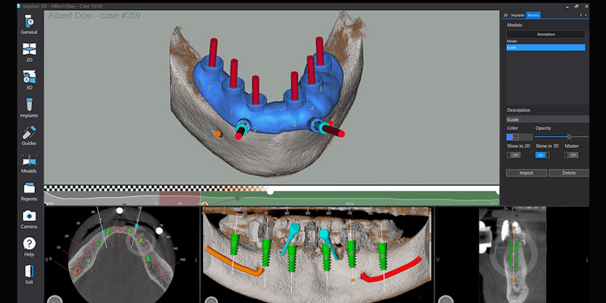 3D tools